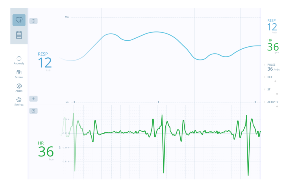 A heart rate graph